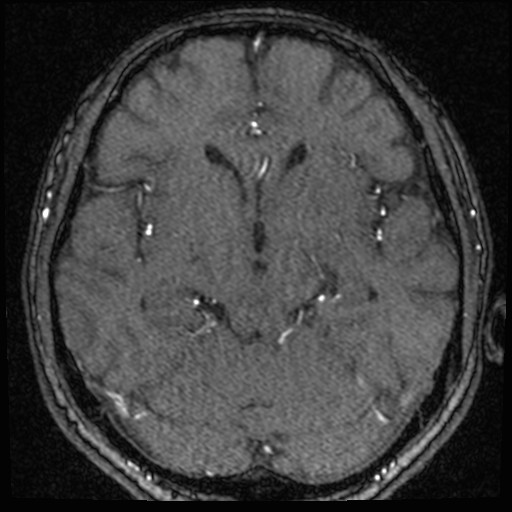 Click on the Serie image to view the images of VILLANUEVA, WILLIAM A.